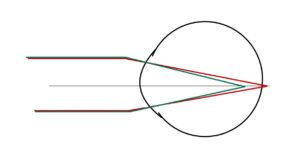 Duochorme Test Principle