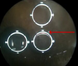 Keratometry - OptomInSight