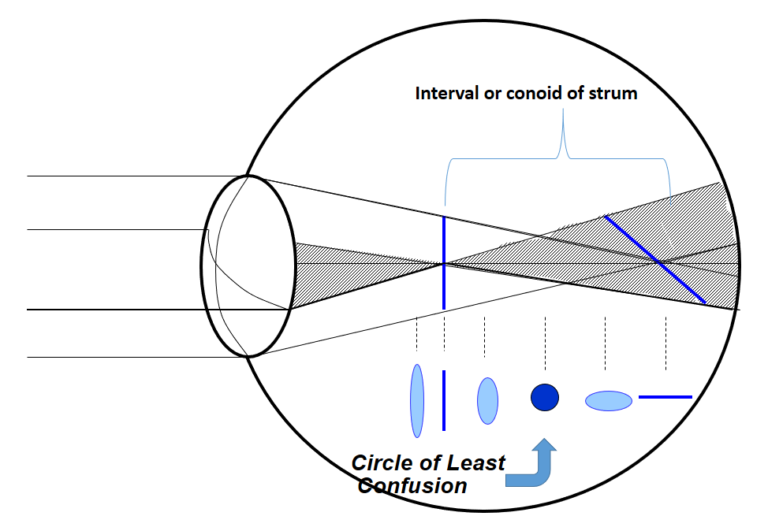 Jackson Cross Cylinder - Optometryblogs