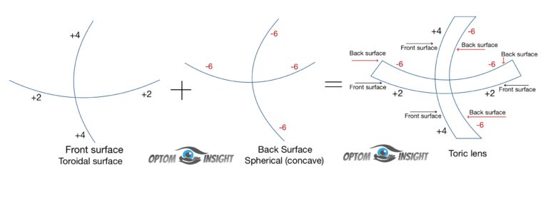 Front and back surface of toric lens