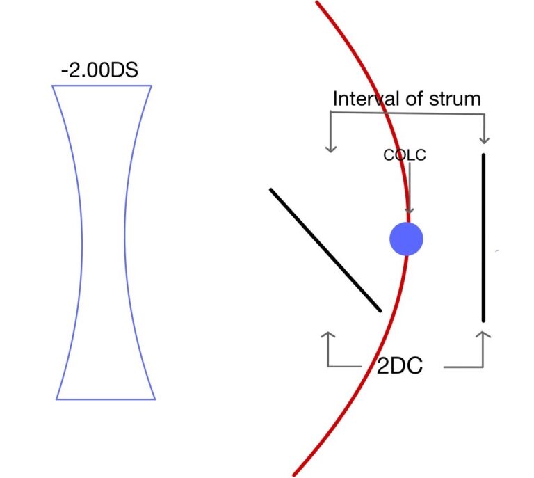 Astigmatism charts - OptomInSight