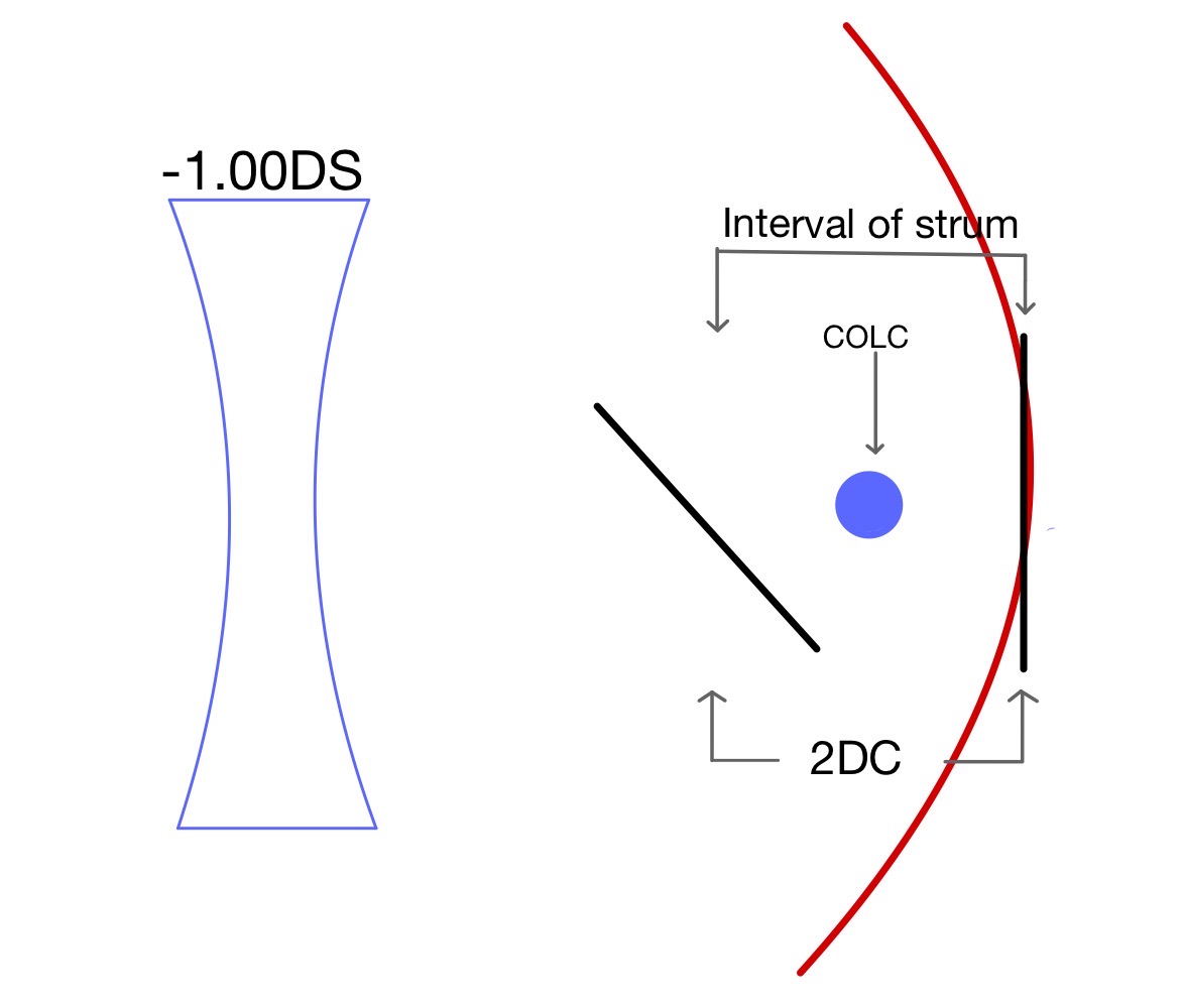 Astigmatism Charts Optominsight