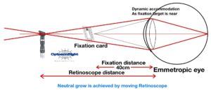 Nott retinoscopy