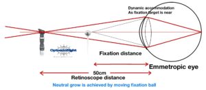 Bell retinoscopy